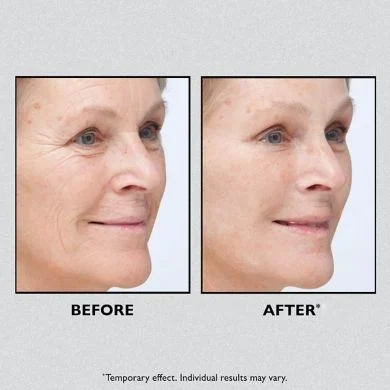 🎁Today 49% OFF🎁Temporary Face Tightener